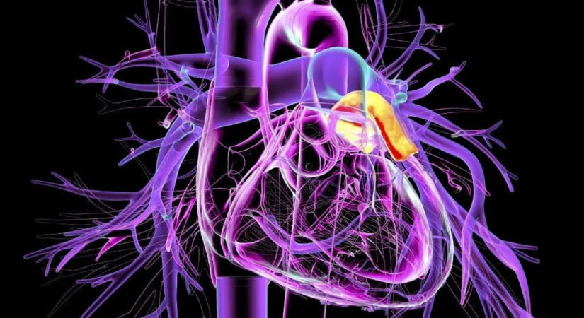 Stroke-ot kapott a négyéves kislány, az orvosok szerint egy gyakori betegség állhat a háttérben