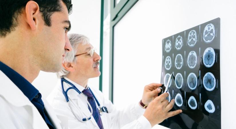 Egyre jobban értjük, hogyan gyilkol a stroke