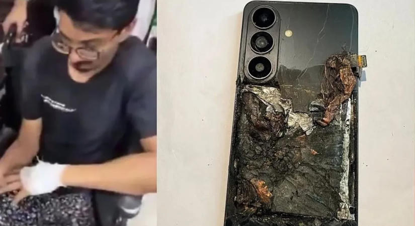 Felrobbant Samsung telefon miatt sérült meg egy férfi az ágyékánál