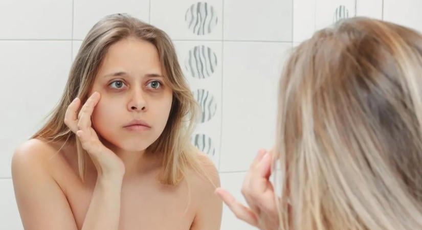 Ferritin arc: mi ez, hogyan ismerhető fel és mit tehetünk ellene?