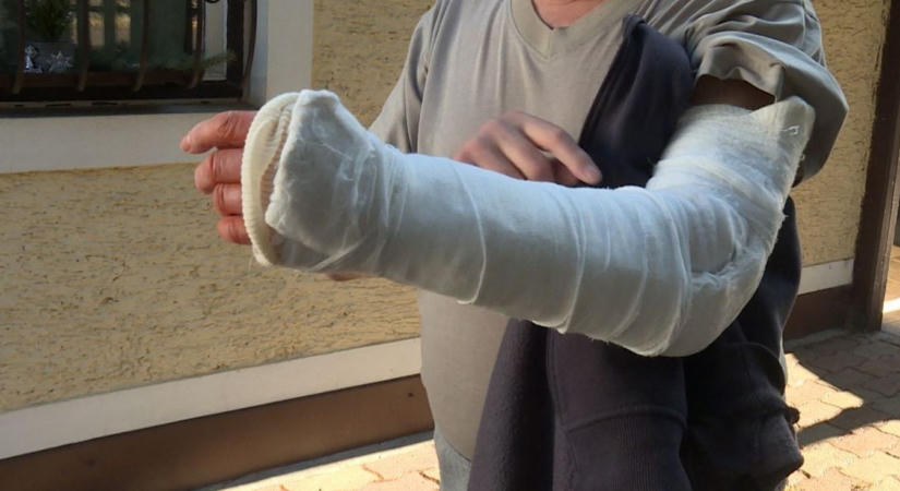 Egy pillanat alatt elszabadult a pokol: súlyos következménye lett a kutyatámadásnak