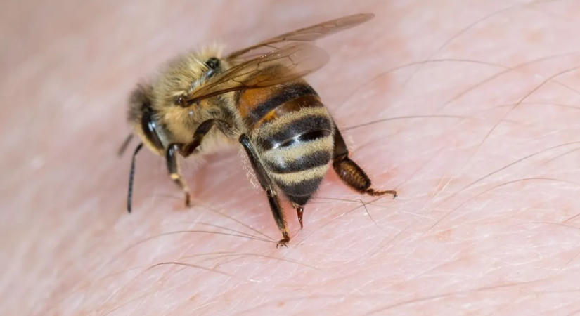 Ezekre az életveszélyes tünetekre figyelj darázscsípés esetén