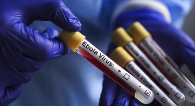 Meghaladta a 3000-et az ebolajárvány áldozatainak száma Kongóban