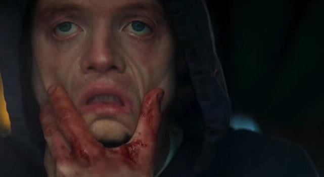 Ha nem szereted a tűket, inkább takard el a szemed az Agyagpofa új előzetese közben