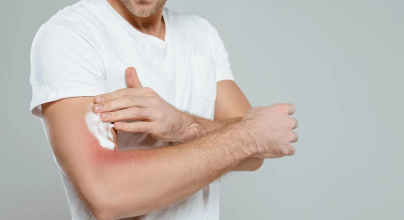 Így hat a tartós stressz a bőrünkre: szakértői tanácsok a regenerációhoz