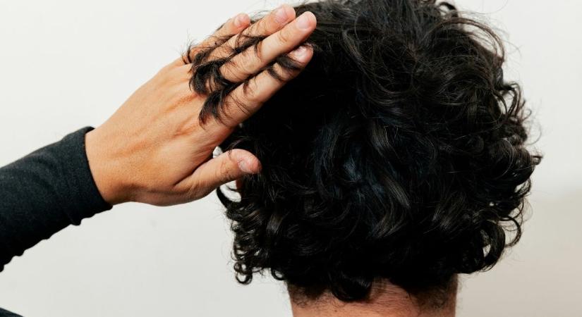 A legtöbben hajhullásra gyanakodnak – egészen más is okozhatja a fejbőr bizsergését
