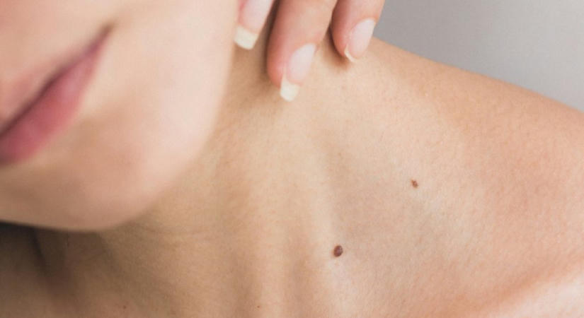 Friss kutatás: a magyarok közel fele még soha nem vett részt anyajegyszűrésen