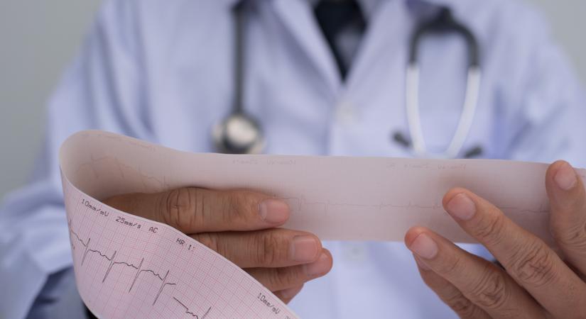 Terheléses vagy nyugalmi EKG - mikor, melyikre van szükség? A kardiológus elmagyarázza