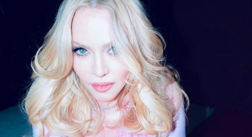 Mi történt Madonna arcával? Annyira sima lett, mint egy 20 évesé – Galéria