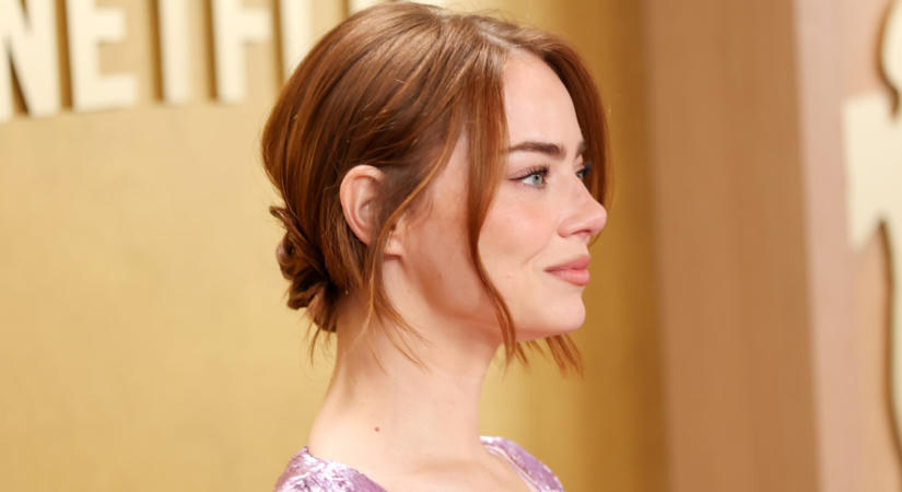 Emma Stone új fotói miatt újra fellángoltak a plasztikai találgatások
