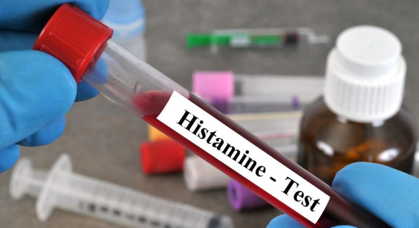 Rejtett összefüggések – hogyan ismerhető fel a hisztaminérzékenység?