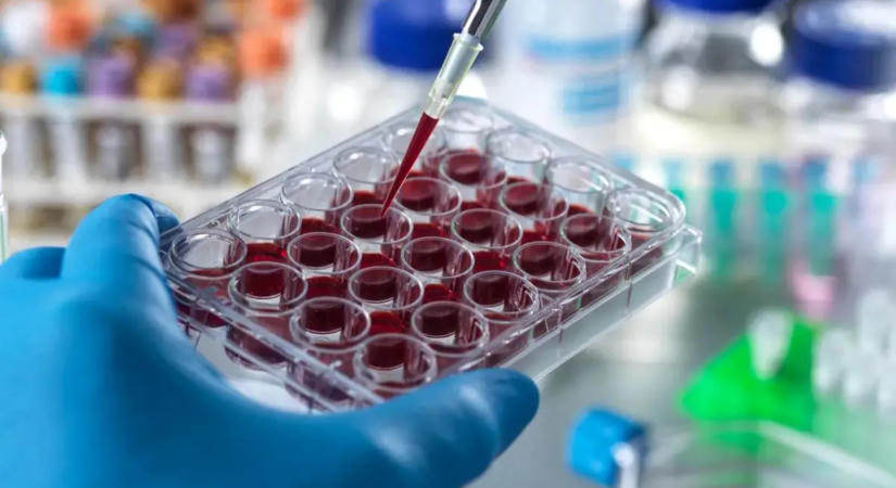 Alacsony tesztoszteronszint és rák: 26 ezer férfi adatai mutattak fontos összefüggést