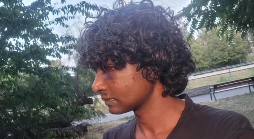 Nyitrai támadás: letartóztatnák az indiaiakat megtámadó tinédzsert