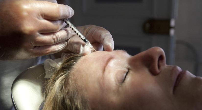 A botoxinjekciók az agy működését is megváltoztatják