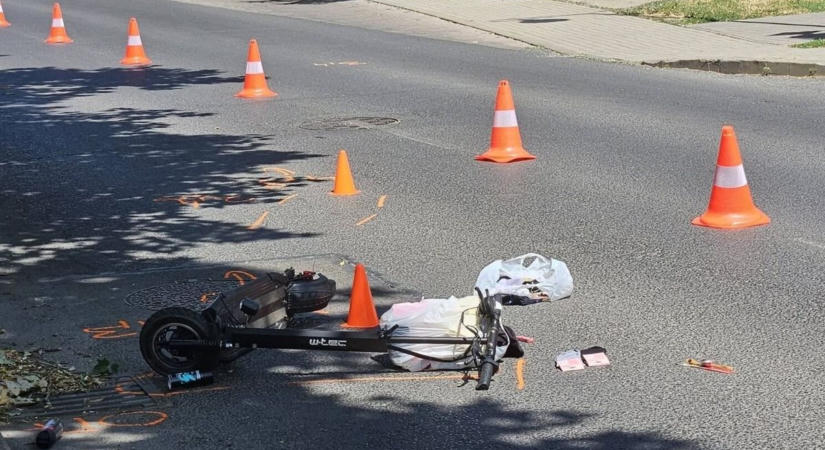 Kimondták az orvosok a sokkoló számok után: 18 év alatt tiltsák be a elektromos rollert!