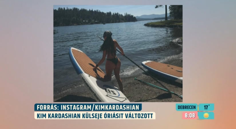 Botox, orrplasztika, vagy csak smink? Plasztikai sebész elemzi Kim Kardashian külsejét