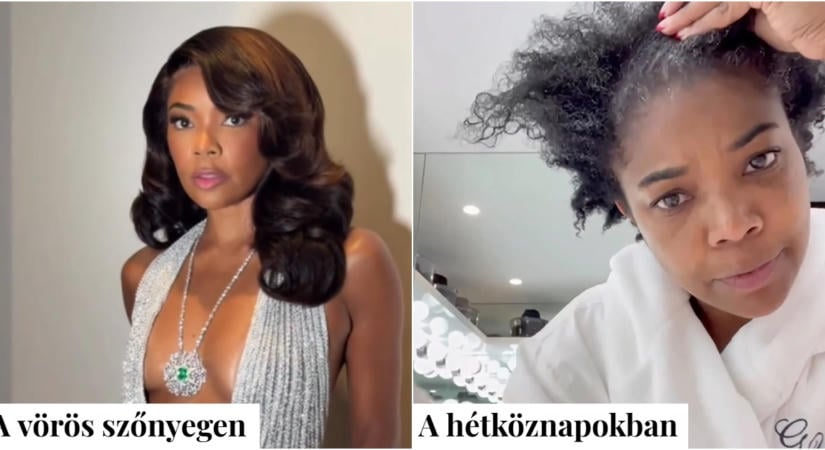 Így néz ki Nicole Kidman igazából paróka nélkül