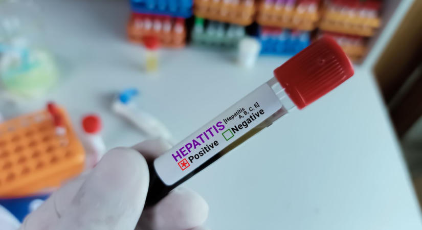 Hepatitis: az uniós átlagnál jóval rosszabb a magyar helyzet