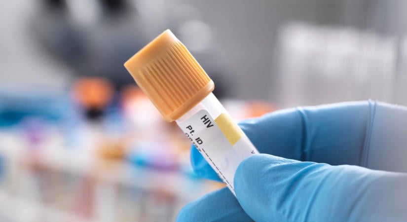 A lábán lévő foltok árulták el: egyre több HIV-fertőzést találnak, sokan túl későn jutnak diagnózishoz