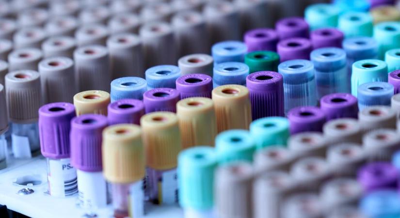 A magyar cég mikroszkópjaival vizsgálták először a koronavírust – Európában is piacvezető