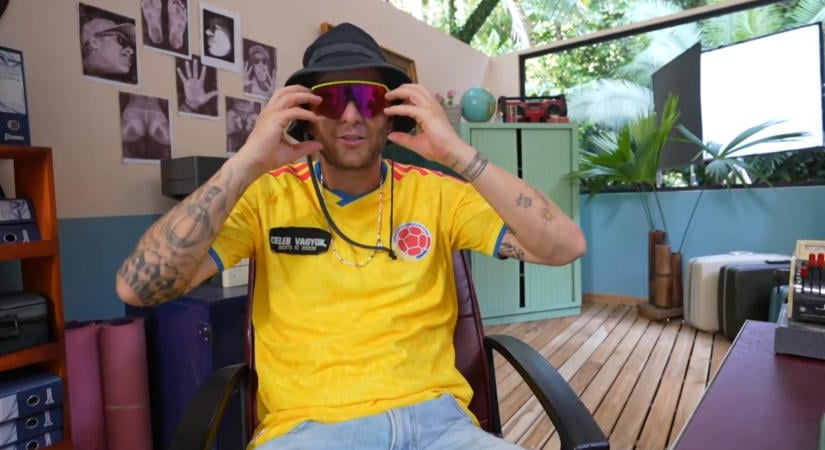 Istenes Bence arca napról napra változik a Celeb vagyok-ban történt balesete után