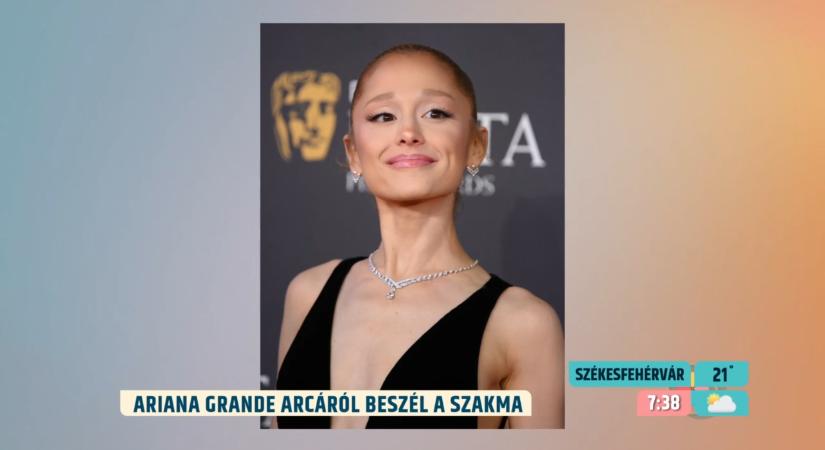 Mi történt Ariana Grande arcával? Plasztikai sebész elemezte a látványos változást