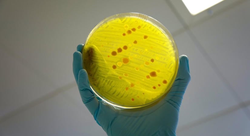 Pestisgyanú Oroszországban: már az amerikai nagykövetség is riasztást adott ki