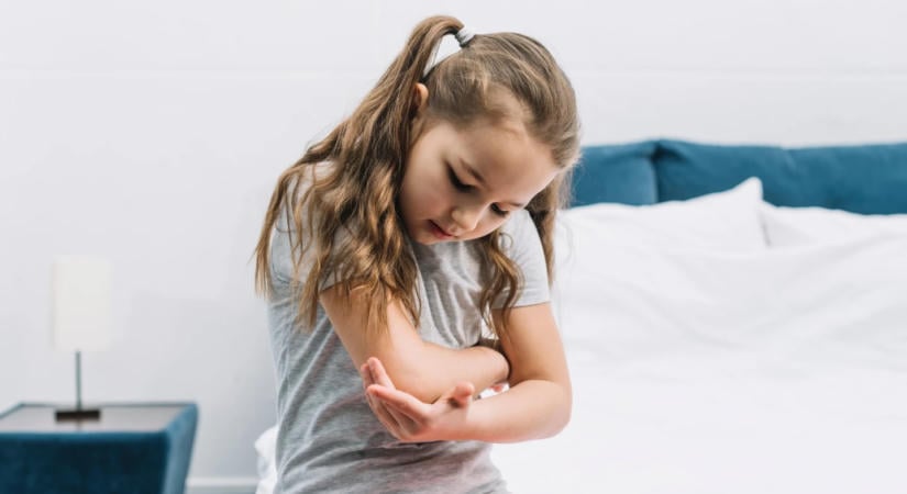 Mi csípett meg? Így különböztesd meg a leggyakoribb nyári csípéseket