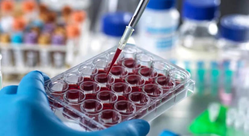 Új technológia segítheti a ritka betegségek és daganatok elleni gyógyszerek kutatását