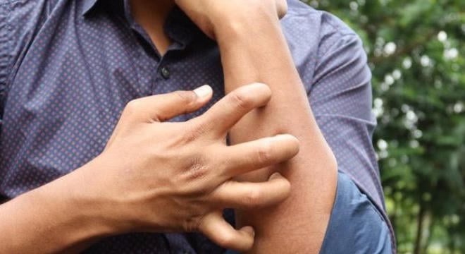 Keresztallergia tünetei és a leggyakoribb pollen-élelmiszer kapcsolatok