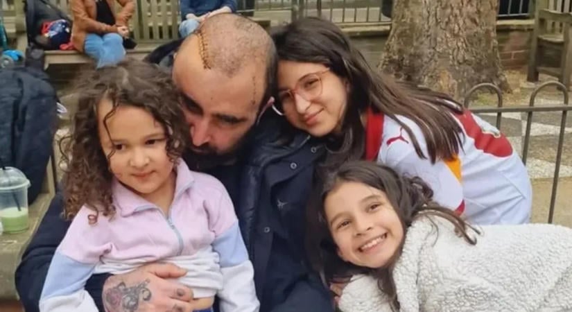 Agresszív rákos betegséggel diagnosztizálták az apát, aki azt hitte, csupán migrénnel küzd