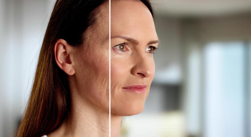 Megereszkedett az arcbőröd? Ez a 6 vitamin belülről támogathatja a kollagéntermelést
