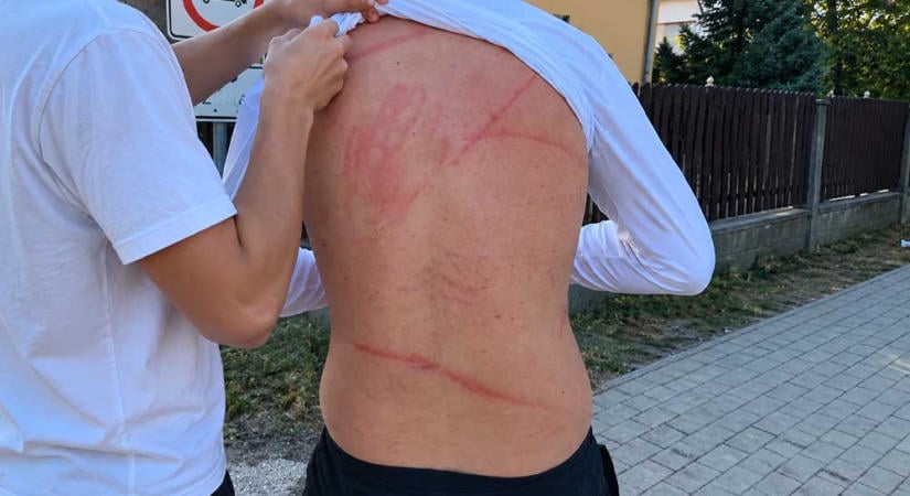 Brutális támadás Pilisen: Botokkal és faágakkal vertek véresre egy 15 éves fiút, a polgármester rendőrségi fellépést követel