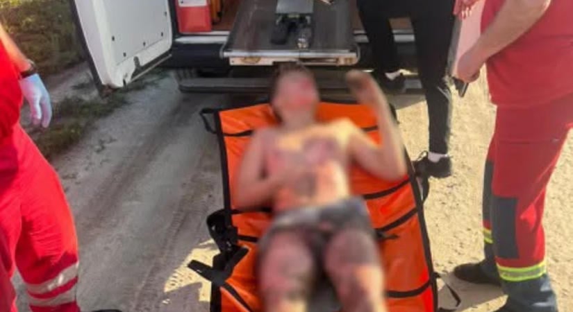 Áramütés ért egy 13 éves fiút Lembergben, miközben szelfit készített egy vonatkocsi tetején