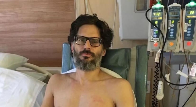 Drámai fotókat posztolt a kórházból Joe Manganiello: megmutatta betegsége pusztító következményeit