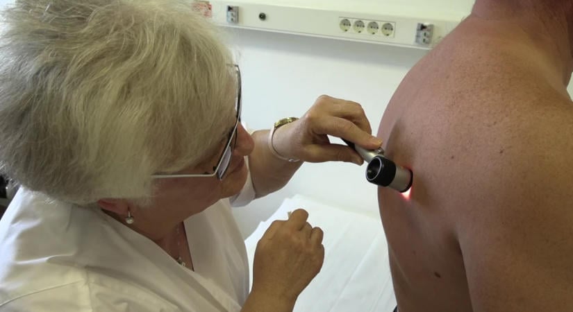 Bőrünk egészségéért – testszkennerre gyűjtenek