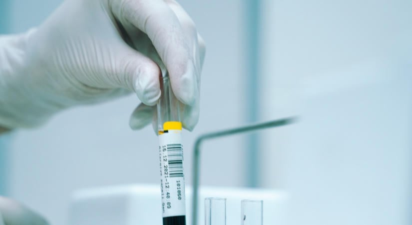 Egy vércsoportnál 28 százalékkal nagyobb a cukorbetegség kockázata