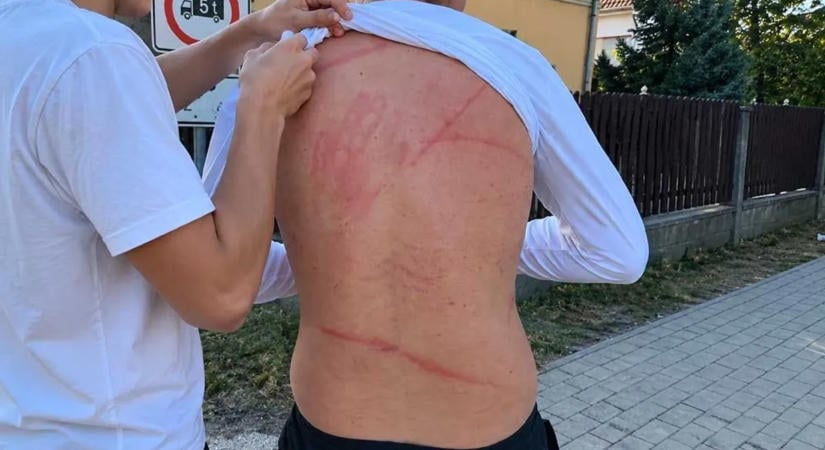 Botokkal verték véresre a 15 éves fiút Pilisen, a polgármester is közbelépett - videó