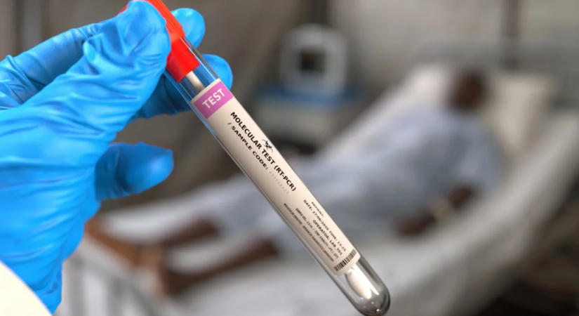 Gyorstesztekkel segíti az Európai Unió a kongói ebolajárvány elleni védekezést