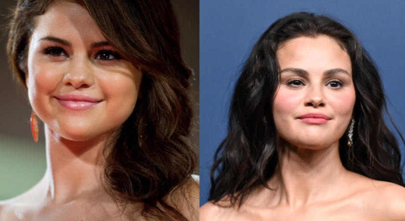 Selena Gomez arca teljesen megváltozott – az Emmy-gálán már alig lehetett ráismerni