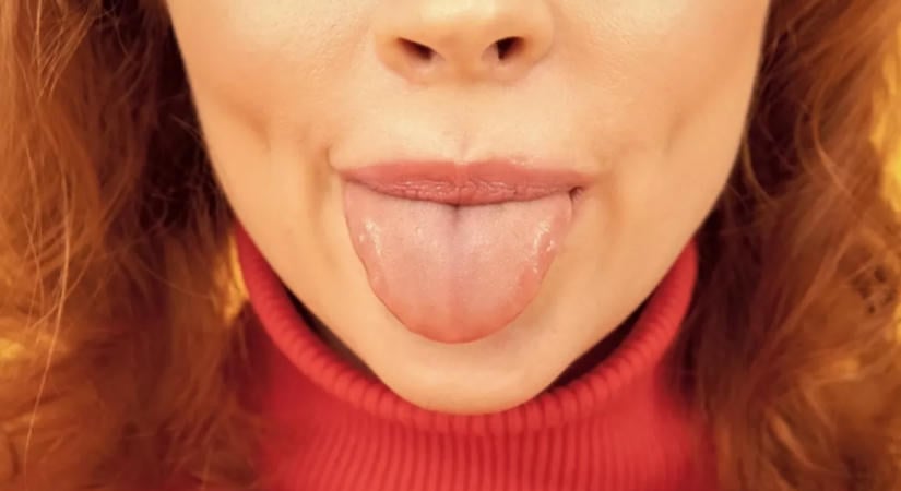 Nem játék: ha ilyen színű a nyelved reggel, azonnal menj orvoshoz