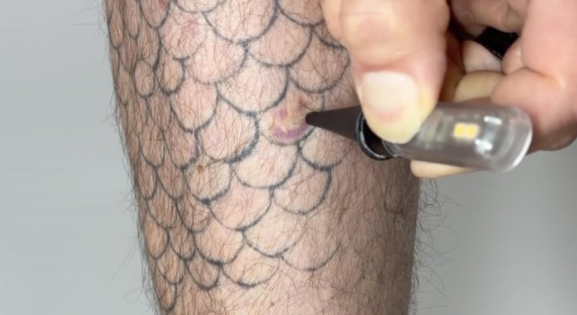 Fénnyel vezérelhető tetoválásokat fejlesztettek ki