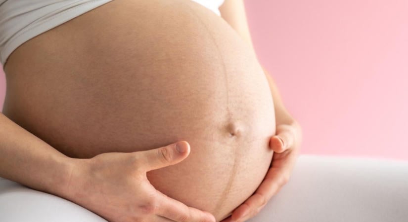 Ijesztő bőrelváltozások, amelyek a terhesség alatt jelenhetnek meg – de nyugi, ártalmatlanok!