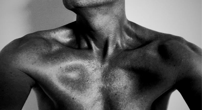 Anorexiás katonákat küldenek frontra az ukránok