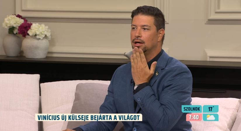 Sírni sem tudnak a botoxtól a sztárfocisták? – Dr. Kovács András a játékosok szépészeti beavatkozásairól