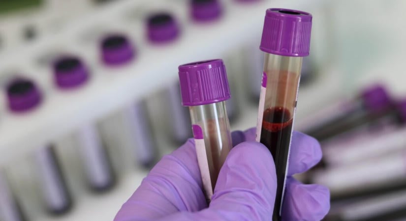 Újabb megbetegés történhetett az orosz pestislaborban