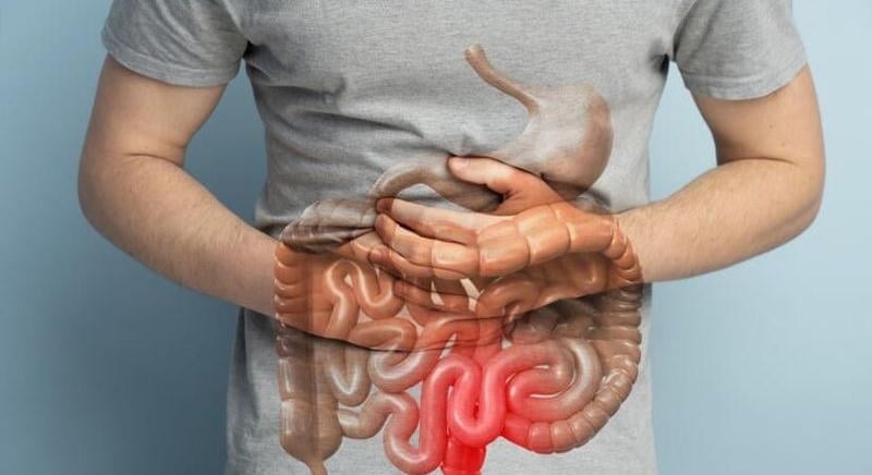 Enyhítheti a Crohn-betegség tüneteit a CBD?