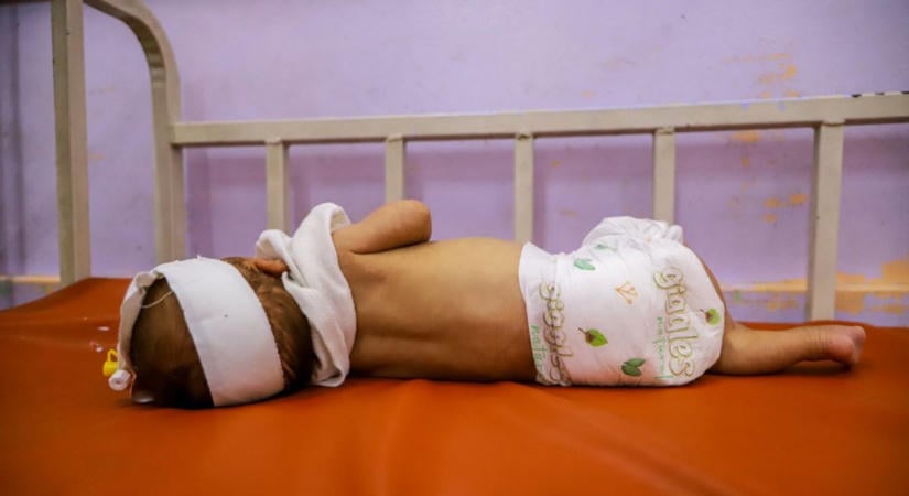 Babák halnak meg egy gyógyítható betegség miatt – riasztó a helyzet
