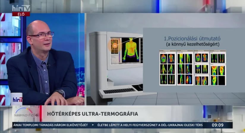 Teljes testet vizsgáló diagnosztika: hogyan működik az ultra-termográfia?