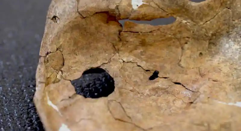 Erőszak és gondoskodás nyomait őrzi egy neandervölgyi csontja